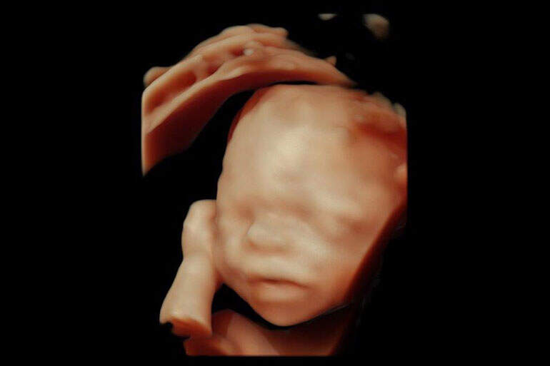 Ultraschall Graz - Frauenarzt Graz - Geburtstermin berechnen